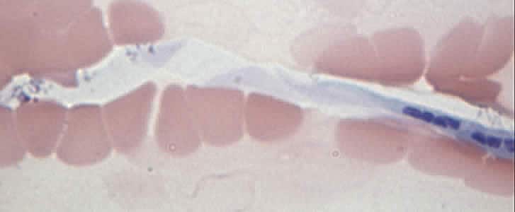 Case168_D.jpg