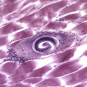 Case170_A.jpg