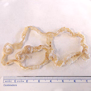 Case172_A.jpg