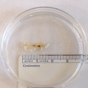 Case172_B.jpg