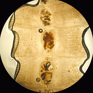 Case172_C.jpg