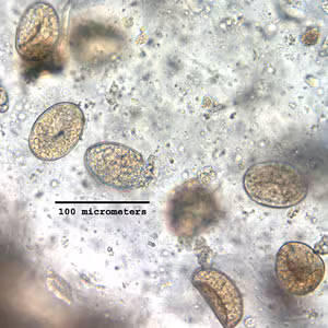 Case172_F.jpg