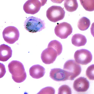 Case173_A.jpg