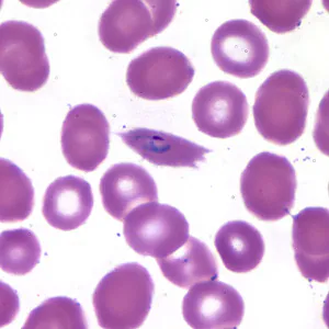 Case173_B.jpg