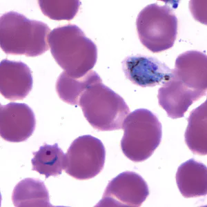 Case173_C.jpg