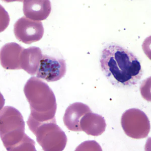 Case173_D.jpg