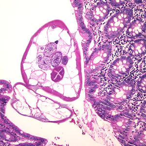 Case174_A.jpg