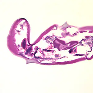 Case174_D.jpg