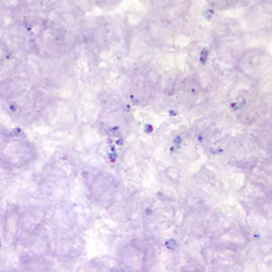 Case177_A.jpg