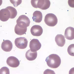 Case177_B.jpg