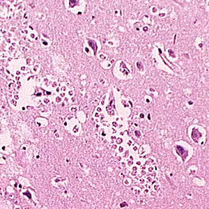 Case181_A.jpg