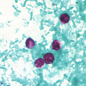 Case183_A.jpg
