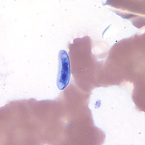 Case184_A.jpg