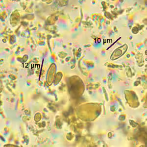 Case186_A.jpg