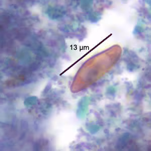 Case186_B.jpg
