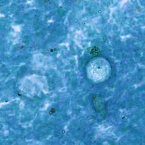 Case187_A.jpg