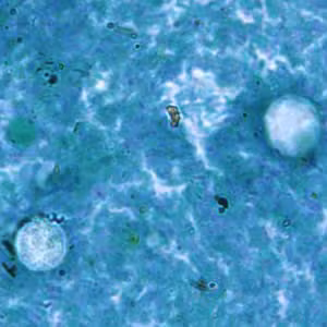 Case187_B.jpg