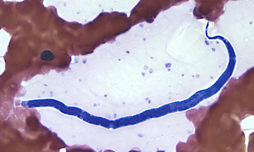Case188_A.jpg