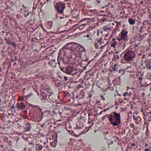 Case192_B.jpg