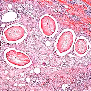 Case193_A.jpg