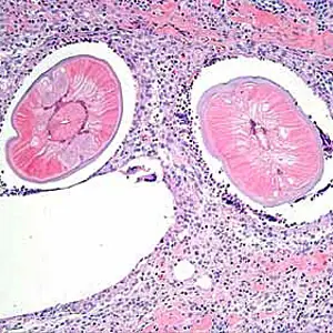 Case193_B.jpg