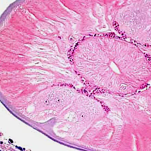 Case193_C.jpg