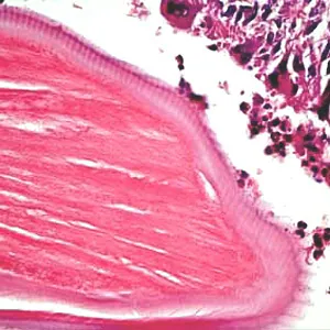 Case193_D.jpg