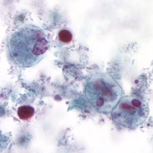 Case194_A.jpg