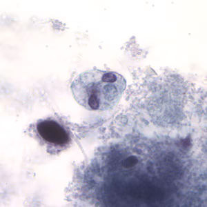Case194_D.jpg