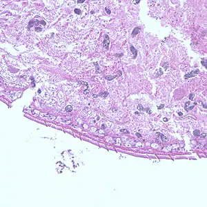 Case195_C.jpg Case195
