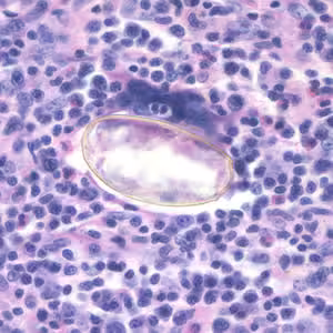 Case195_D.jpg Case195