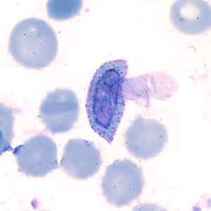 Case202_A.jpg Case202
