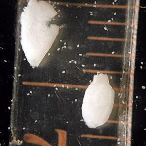 Case204_A.jpg Case204