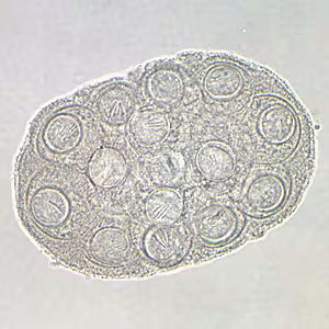 Case204_D.jpg Case204
