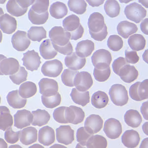 Case209_B.jpg Case209