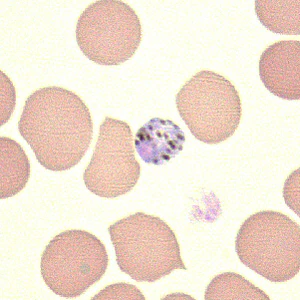 Case211_D.jpg Case211