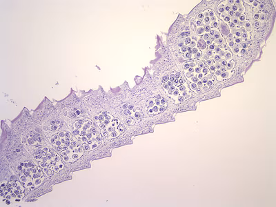 Case212_C.jpg Case212