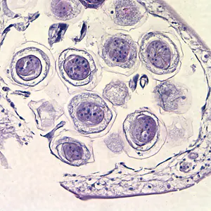 Case212_D.jpg Case212