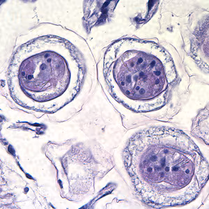 Case212_E.jpg Case212