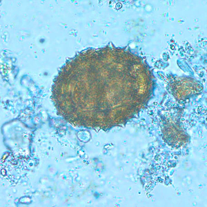 Case216_A.jpg