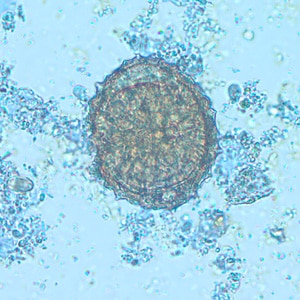 Case216_C.jpg Case216