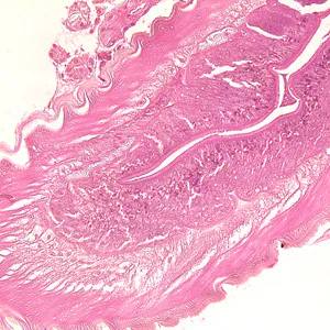 Case236_B.jpg