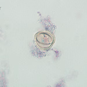 Case237_D.jpg