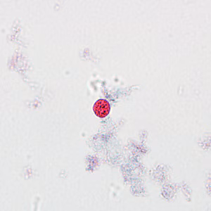 Case237_E.jpg