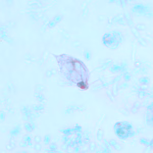 Case239_A.jpg