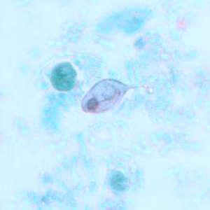 Case239_B.jpg