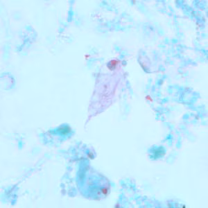 Case239_C.jpg