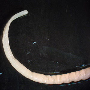 Case241_B.jpg