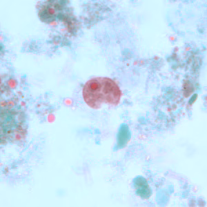 Case243_A.jpg