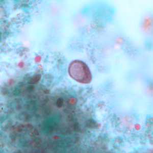 Case243_C.jpg